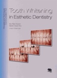 So-Ran Kwon et Seok-Hoon Ko - Tooth Whitening in Esthetic Dentistry - 2 volumes.