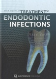 José Siqueira et Isabel N. Rocas - Treatment of Endodontic Infections.