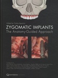 Carlos Aparicio - Zygomatic Implants - The Anatomy-Guided Approach.