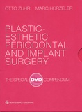 Otto Zuhr et Marc Hürzeler - Plastic-Esthetic Periodontal and Implant Surgery - The special DVD compendium. 4 DVD