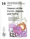 Marisa R. Nucci et Christopher P. Crum - Tumors of the Cervix, Vagina, and Vulva.
