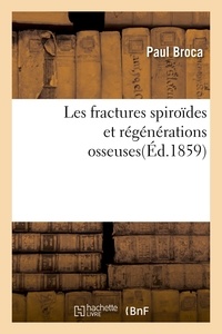 Paul Broca - Les fractures spiroïdes et régénérations osseuses.