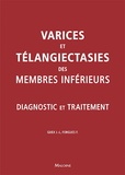 Jean-Jérôme Guex et Fannie Forgues - Varices et téléangiecasties des membres inférieurs - Diagnostic et traitement.