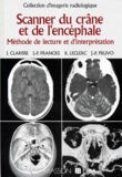 Jacques Clarisse et Jean-Paul Francke - Scanner Du Crane Et De L'Encephale. Methode De Lecture Et D'Interpretation.