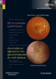 Gilles Chaine et Sylvia Nghiêm-Buffet - Rétine - Volume 5, Oeil et maladies systémiques ; Anomalies et affections non glaucomateuses du nerf optique.