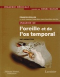 Francis Veillon - Imagerie de l'oreille et de l'os temporal - Tome 2, Inflammation.