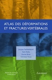 Jacques Fechtenbaum et Sami Kolta - Atlas des déformations et fractures vertébrales.