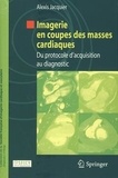 Alexis Jacquier - Imagerie en coupes des masses cardiaques - Du protocole d'acquisition au diagnostic.