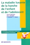Alain Dimeglio et  Collectif - La Maladie Luxante De La Hanche De L'Enfant Et De L'Adolescent.