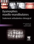 Pierre Canal et Patrick Goudot - Dysmorphies maxillo-mandibulaires - Traitement orthodontico-chirurgical.