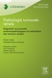 Xavier Leroy et Nathalie Rioux-Leclercq - Pathologie tumorale rénale - Diagnostic et pronostic anatomopathologique et moléculaire des tumeurs rénales.