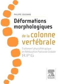 Philippe Souchard - Déformations morphologiques de la colonne vertébrale : traitement physiothérapique en rééducation posturale globale - RPG.