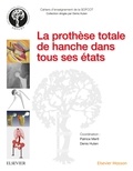 Patrice Mertl et Denis Huten - La prothèse totale de hanche dans tous ses états.
