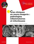 François Cotton et Stéphane Kremer - Cas cliniques en neuro-imagerie - Pathologies inflammatoires et infectieuses.