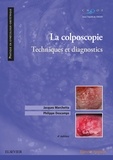 Jacques Marchetta et Philippe Descamps - La colposcopie - Techniques et diagnostics.