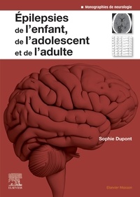 Sophie Dupont - Epilepsies de l'enfant, de l'adolescent et de l'adulte.