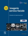 Frédérique Dubrulle et Nadine Martin-Duverneuil - Imagerie cervico-faciale - Massif facial - Sinus - Voies aérodigestives supérieures - Pathologies cervicales - Espaces profonds de la face.