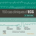 John R. Hampton et David Adlam - 150 cas cliniques d'ECG.