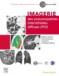 Mathieu Lederlin et Samia Boussouar - Imagerie des pneumopathies interstitielles diffuses (PID).