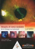 Marc Labetoulle - Herpès et zona oculaire - De la clinique au traitement.