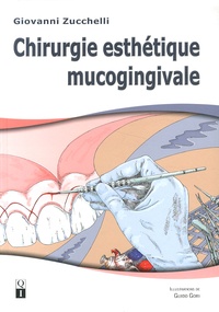 Giovanni Zucchelli - Chirurgie esthétique mucogingivale.