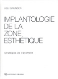 Ueli Grunder - Implantologie de la zone esthétique - Stratégie de traitement.