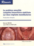 Marcel Begin et Jean-Marie Cheylan - La prothèse amovible complète bimaxillaire stabilisée sur deux implants mandibulaires - Protocoles cliniques.