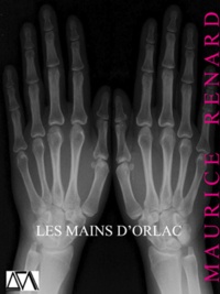 Maurice Renard - Les Mains d'Orlac.