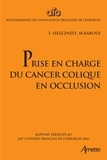 Igor Sielezneff et Mehdi Karoui - Prise en charge du cancer colique en occlusion.