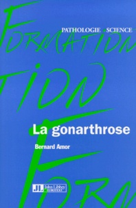 Bernard Amor - La gonarthrose.