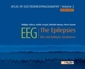 Philippe Gélisse et Arielle Crespel - Atlas of Electroencephalography - Volume 2, The Epilepsies, EEG and Epileptic Syndromes.
