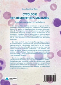 Cytologie des hémopathies malignes. Anomalies sanguines et médullaires