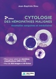 Jean-Baptiste Rieu - Cytologie des hémopathies malignes - Anomalies sanguines et médullaires.
