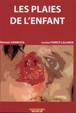 Romain Vanwijck et Louise Forest-Lalande - Les plaies de l'enfant.
