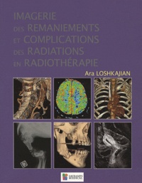 Ara Loshkajian - Imagerie des remaniements et complications des radiations en radiothérapie.