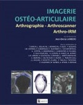 Jean-Denis Laredo - Imagerie ostéo-articulaire - Arthrographie, arthroscanner, arthro-IRM.