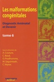 Alain Couture et Catherine Baud - Les malformations congénitales - Diagnostic anténatal et devenir Tome 6.