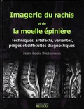 Jean-Louis Dietemann - Imagerie du rachis et de la moelle épinière - Techniques, artéfacts, variantes, pièges et difficultés diagnostiques.