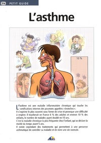 Alice Villepoux - L'asthme.