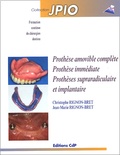 Jean-Marie Rignon-Bret et Christophe Rignon-Bret - Prothese Amovible Complete, Prothese Immediate, Protheses Supraradiculaire Et Implantaire.