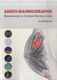 Ara Loshkajian - Angio-mammographie - Mammographie de contraste spectrale (CESM).