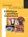François Unger - Concepts cliniques en Esthétique et prothèse implantaire.