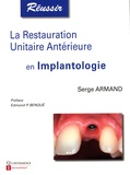Serge Armand - La restauration unitaire antérieure en implantologie.