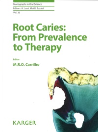 Marcela Rocha de Olivera Carrilho - Root Caries: From Prevalence to Therapy.