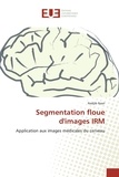 Nadjib Nasri - Segmentation floue d'images IRM - Application aux images médicales du cerveau.