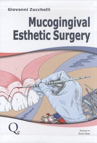 Giovanni Zucchelli - Mucogingival Esthetic Surgery.