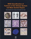 Holger Moch et Peter-A Humphrey - WHO Classification of Tumours of the Urinary System and Male Genital Organs.