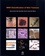 D. E. Elder et D. Massi - Who Classification of Skin Tumours.