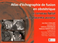 Jean-Marc Levaillant et Laurence Gitz - Le cerveau foetal et le placenta accreta - Atlas d'échographie de fusion en gynécologie.