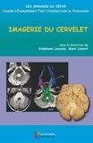 Stéphane Louryan et Marc Lemort - Imagerie du cervelet.